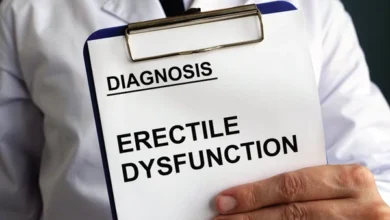 ICD 10 For Erectile Dysfunction
